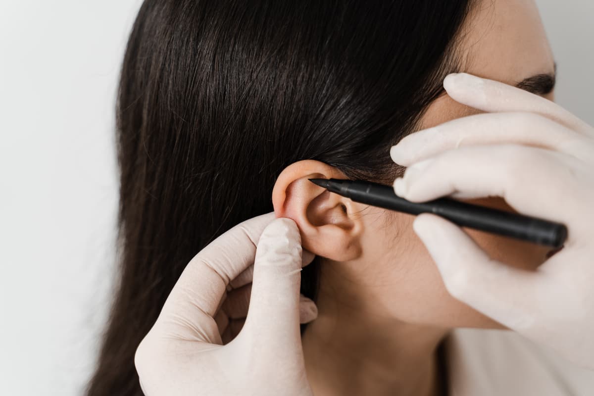 otoplasty: precision ear alignment surgery